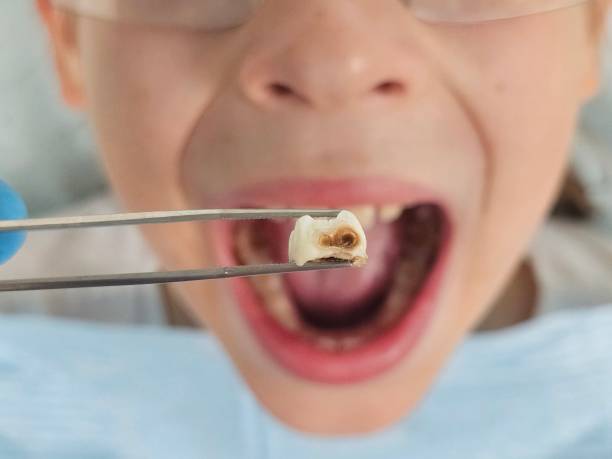Best Cracked Tooth Emergency Dentist  in , IN