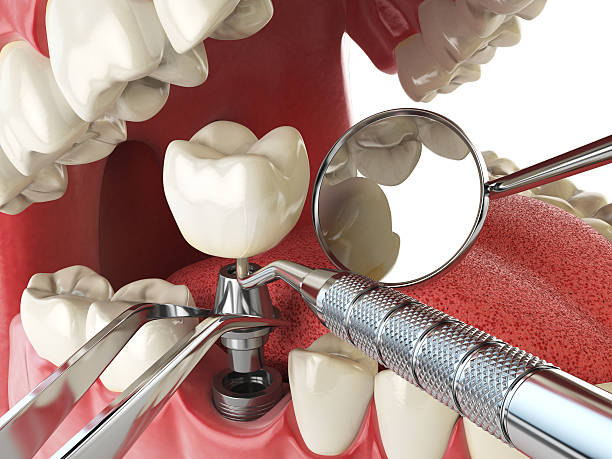 Best Urgent Tooth Repair  in , IN
